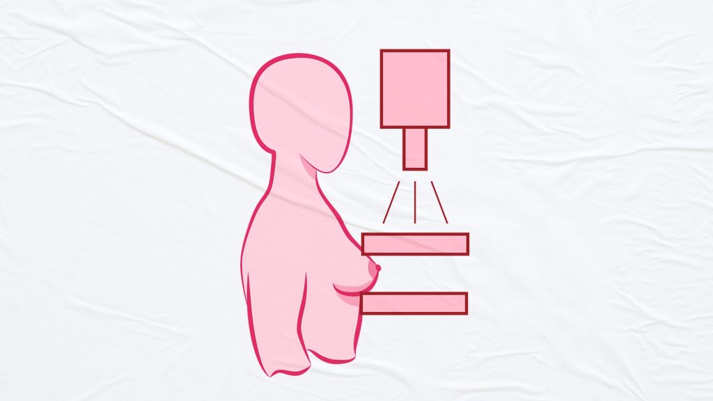 Como é feita a mamografia